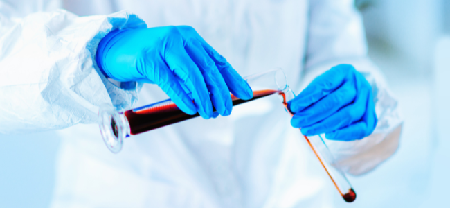 Un investigador con guantes azules mide la concentración de sulfuroso en vino utilizando tubos de ensayo en un laboratorio